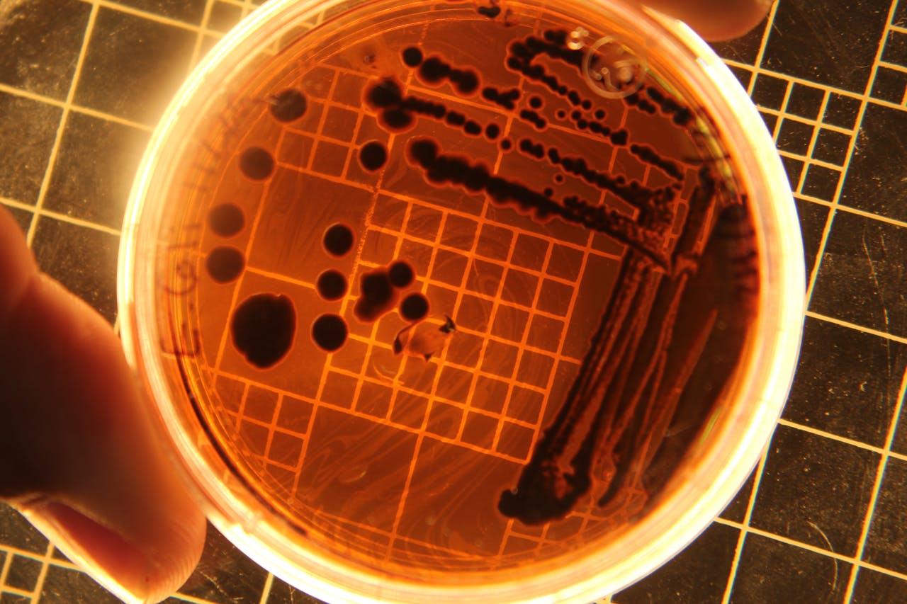 Escherichia coli